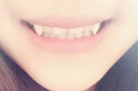Vampire Fangs